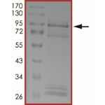 EGFR (C775S T790M L858R), Active